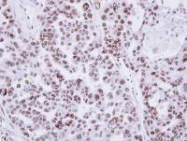 NBP1-32543 - ZMAT3