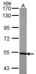 NBP1-32567 - PPP3CB / CALNA2