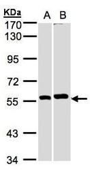 NBP1-32567 - PPP3CB / CALNA2