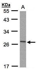NBP1-32568 - IL1RN / IL1RA