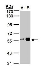 NBP1-32602 - RCC2
