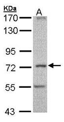 NBP1-32659 - DYNC1I1