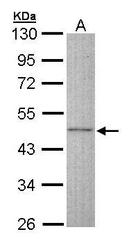 NBP1-32662 - Doublecortin