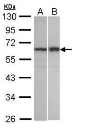 NBP1-32689 - TNIP2