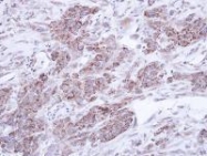 NBP1-32689 - TNIP2