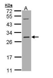NBP1-32696 - RALB