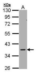 NBP1-32697 - AMPK gamma-2 chain / PRKAG2