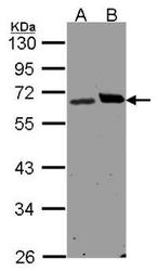 NBP1-32704 - Ribophorin-1 / RPN1