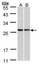 NBP1-32710 - RPL13A