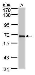 NBP1-32715 - DENND1B