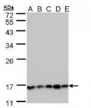 NBP1-32720 - PPP3R1 / Calcineurin B