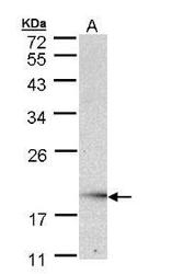 NBP1-32729 - UBE2G2