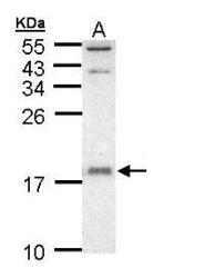 NBP1-32734 - UBE2D1 / SFT