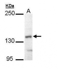 NBP1-32737 - UBE4B