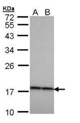 NBP1-32741 - Beta-crystallin A4