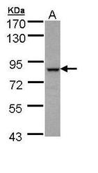 NBP1-32754 - BBS7
