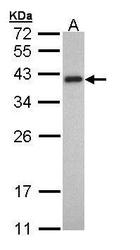 NBP1-32770 - Tropomyosin-2 (TPM2)