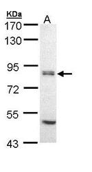 NBP1-32783 - EIF2B5 / EIF2BE