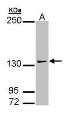NBP1-32784 - AUTS2