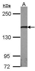 NBP1-32784 - AUTS2