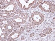 NBP1-32787 - B3GALTL