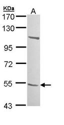NBP1-32787 - B3GALTL