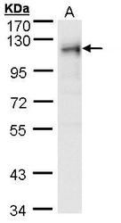 NBP1-32813 - RRBP1