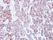 NBP1-32813 - RRBP1