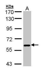 NBP1-32823 - UAP1 / AGX