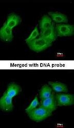 NBP1-32823 - UAP1 / AGX