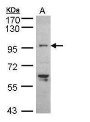 NBP1-32837 - TNNI3K