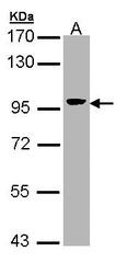 NBP1-32841 - Villin-1