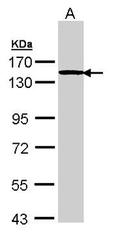 NBP1-32842 - TTF2