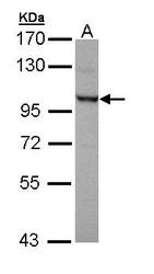 NBP1-32843 - OFD1