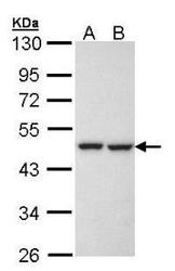 NBP1-32859 - KRR1 / HRB2