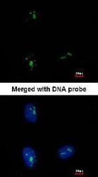 NBP1-32859 - KRR1 / HRB2