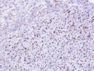 NBP1-32859 - KRR1 / HRB2