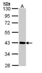 NBP1-32884 - CRTAP