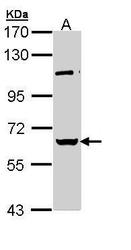 NBP1-32887 - RBMY1A1 / RBMY1C