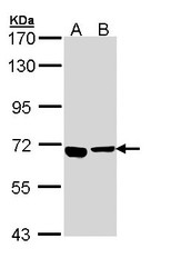 NBP1-32904 - ATP6V0A4