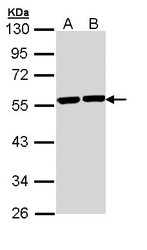 NBP1-32916 - TUBA8 / TUBAL2