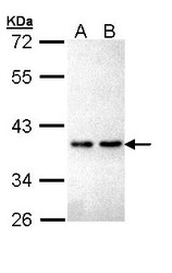 NBP1-32927 - ZNF346