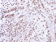 NBP1-32927 - ZNF346