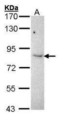 NBP1-32941 - ABP1