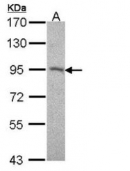 NBP1-32961 - Desmocollin-2