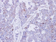 NBP1-32961 - Desmocollin-2
