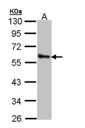 NBP1-32965 - ZNF259