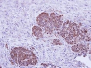 NBP1-32965 - ZNF259