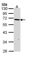NBP1-32978 - JMJD6 / PTDSR