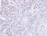 NBP1-32978 - JMJD6 / PTDSR